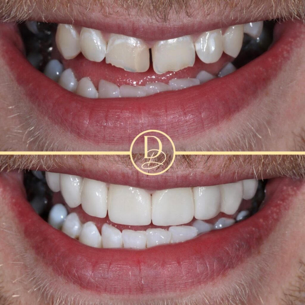 Dental Transformation