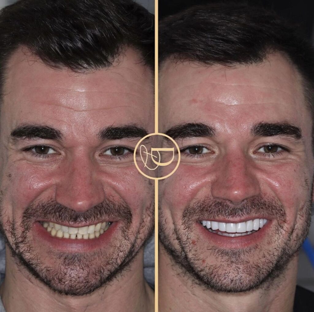 Dental Transformation